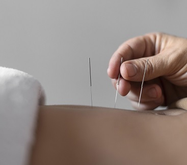 Процедура иглоукалывания 